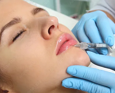 lip filler treatment